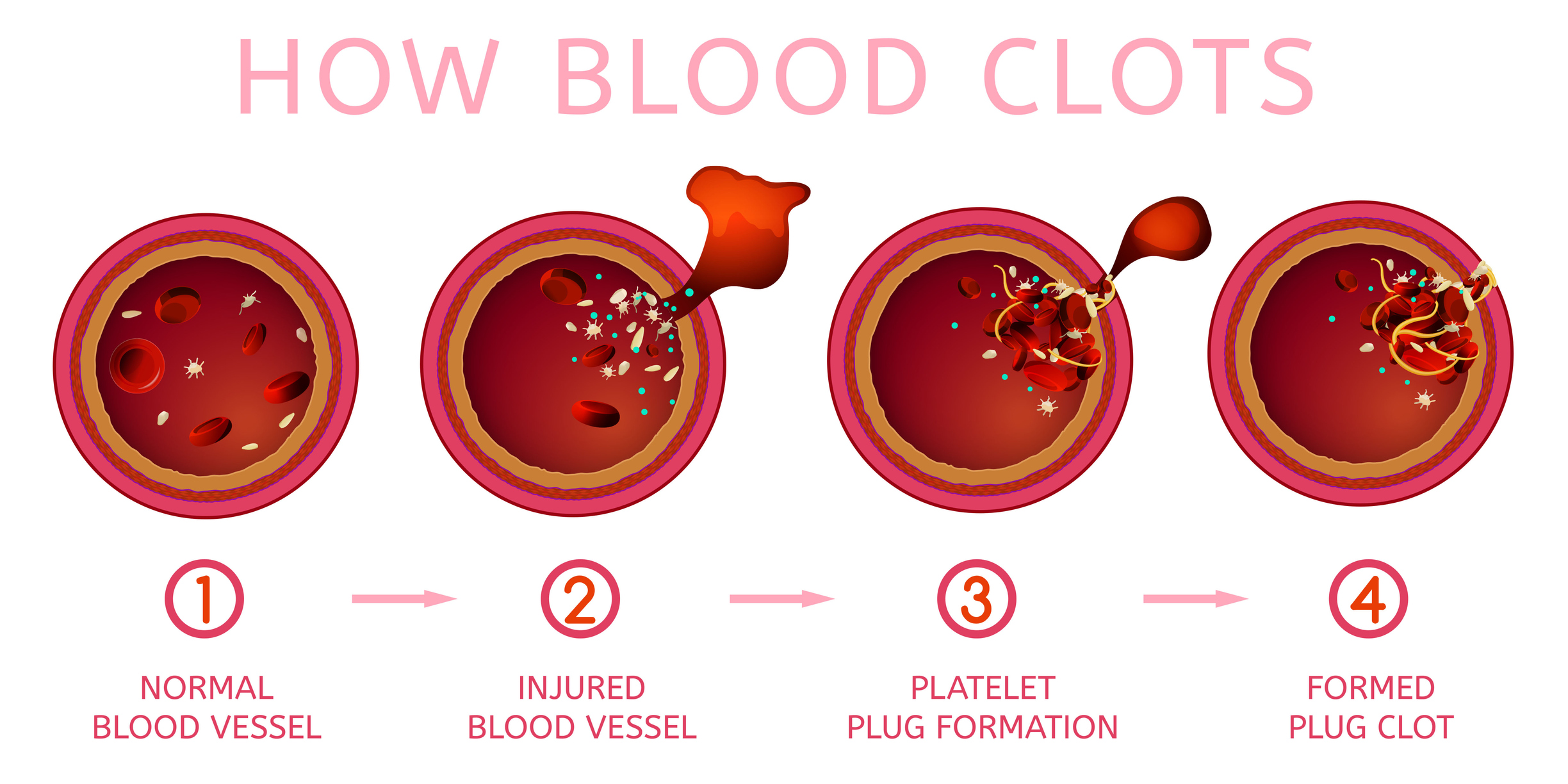 Blood clotting process - Kaleidoscope Fighting Lupus